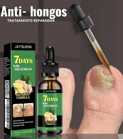 FungiFree™ jengibre🫚 |Tónico Antifúngico para uñas